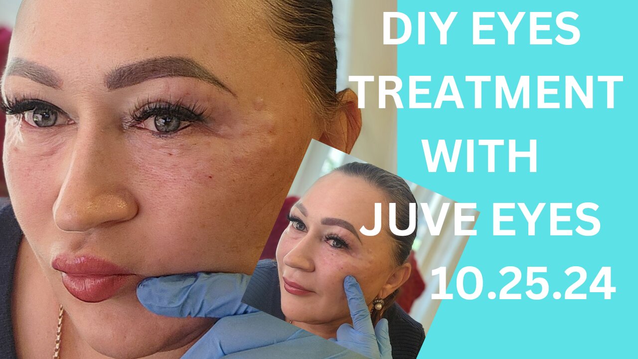 DIY EYES TREATMENT WITH JUVE EYES Polynucleotide 10.25.24 Discount code NAT10