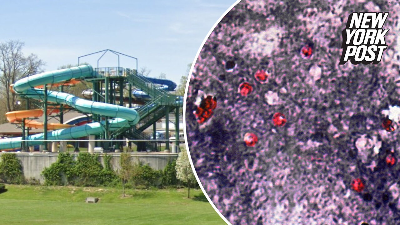 Water park pool diarrhea outbreak tied to parasite