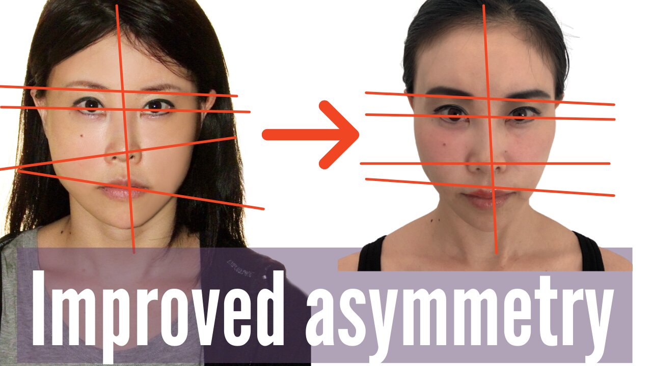 How I improved my facial symmetry