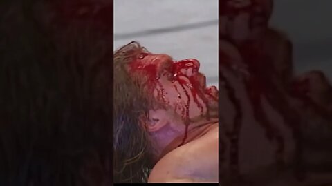 Triple H bleeding !!! Chris Jericho hits him with steel chair ! WWE attitude era #shorts