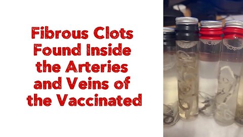 Fibrous Clots Found Inside the Arteries and Veins of the Vaccinated