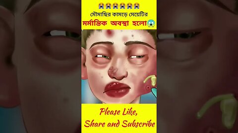 মৌমাছির কামড়ে এ কি হলো মেয়েটির 😱😱 #shorts #youtubeshorts #viral vocalcandy