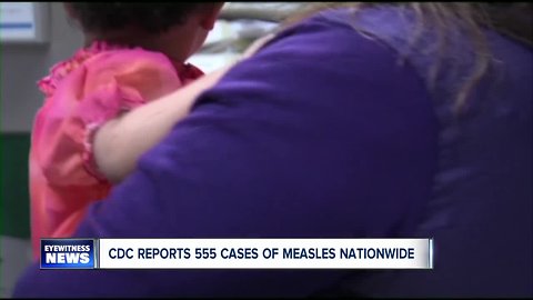 Cases of measles on the rise across the country, 90 confirmed last week