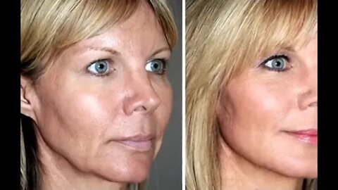 Skin Rejuvenate Using XanthRemover, XanthRemover Helps to Rejuvenate your skin
