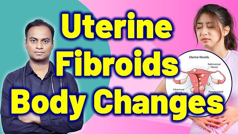 Changes in the Body Due to Uterine Fibroids Treatment Cure Medicine Surgery Gynaecology Women Female