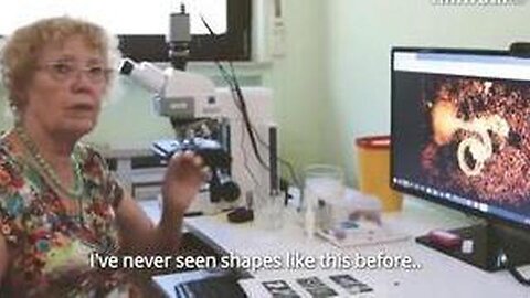 NEW GERMAN VAXXXED BLOOD / VAX SERUM (MICROSCOPE ANALYSIS) EXHIBITS & FINDINGS (WOR REPORT)
