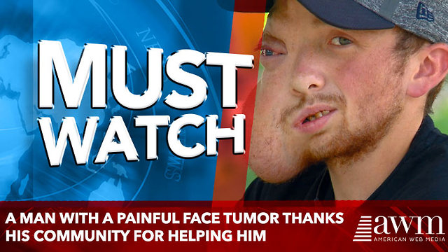 A man with a painful face tumor thanks his community for helping him