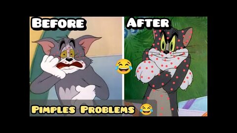 Pimples | Before and After 🤣😂 Tom and jerry