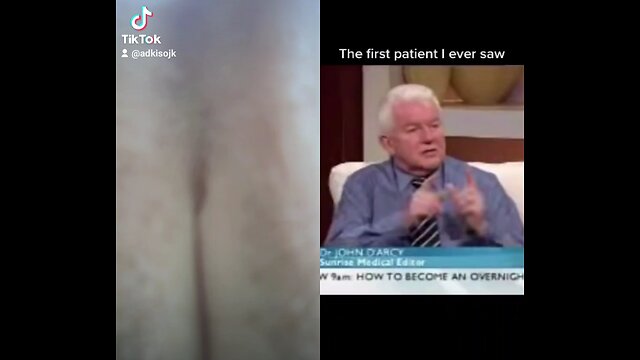 Dr.John Darcy against "Circumcision"