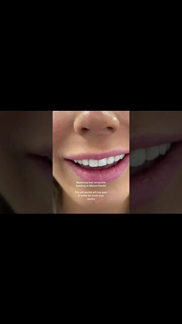 Dental And Teeth Hygiene