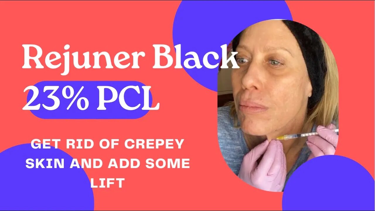 Crepey Neck Treatment ~ 🤗 SASSY10 🤗