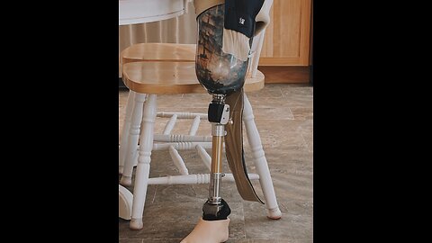 Prosthetic Leg Vlog