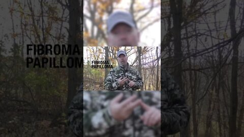 Deer Warts ... #shorts #deer #deerhunting