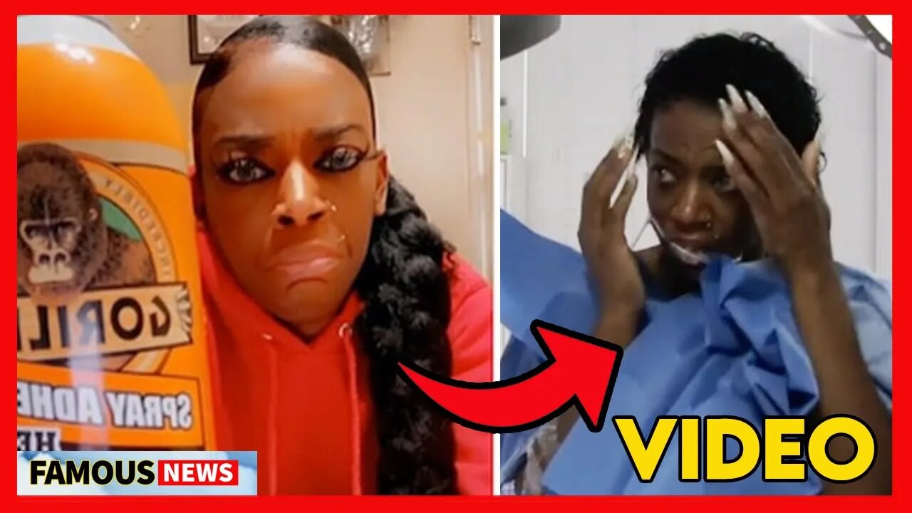 Gorilla Glue Girl Update, She Removed The Glue, Gets Her Hair Back | Famous News