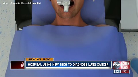 Sarasota doctors use robotic cameras to screen for lung cancer