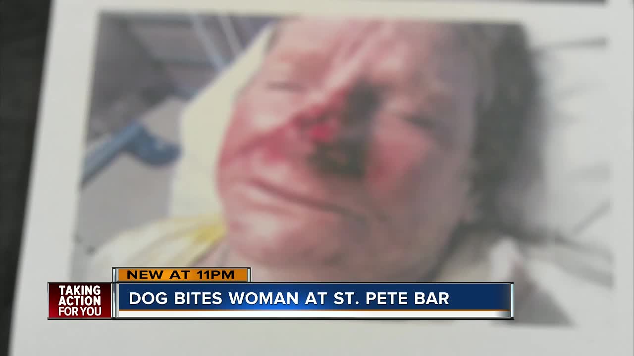 Gulfport woman sues The Dog Bar in St. Pete after dog bites her nose