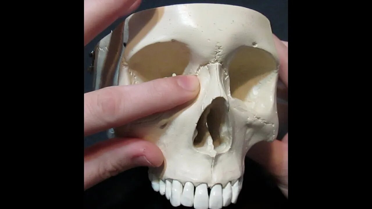 Identification of Bony Landmarks - Maxilla Bone (Skull)