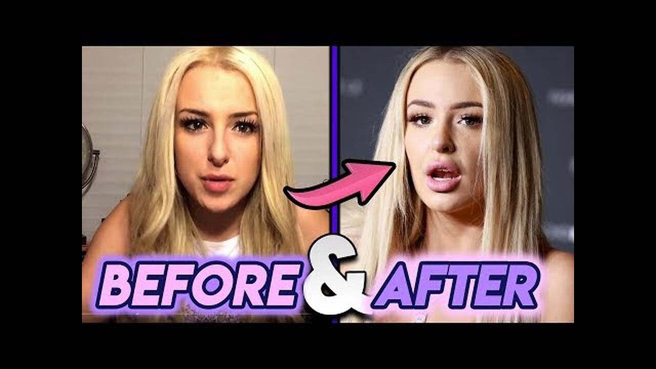 Tana Mongeau - Before and After - Plastic Surgery Transformation