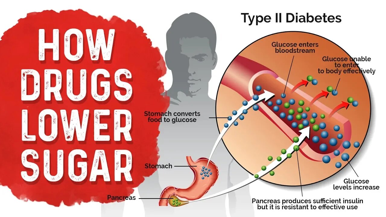 Diabetes Medication Side Effects: Metformin, Sulfonylurea & Insulin – Dr.Berg