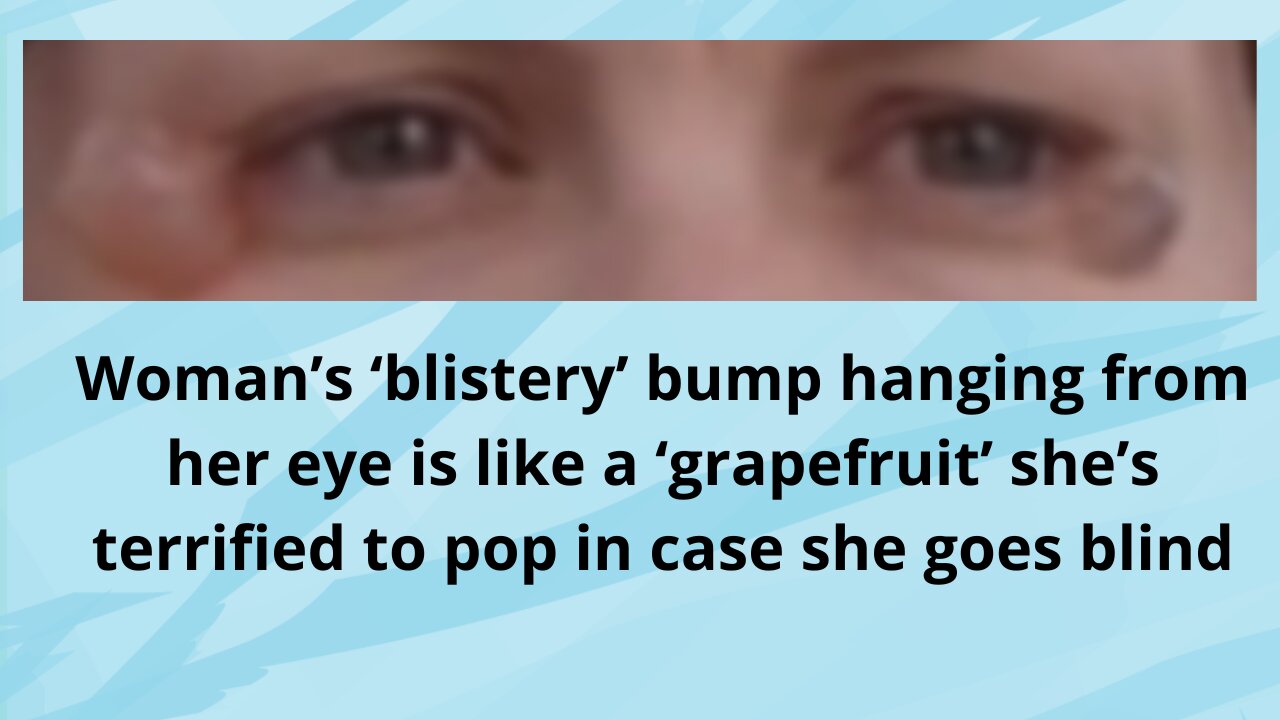 The woman is afraid to pop the "blistery" bulge that hangs from her eye