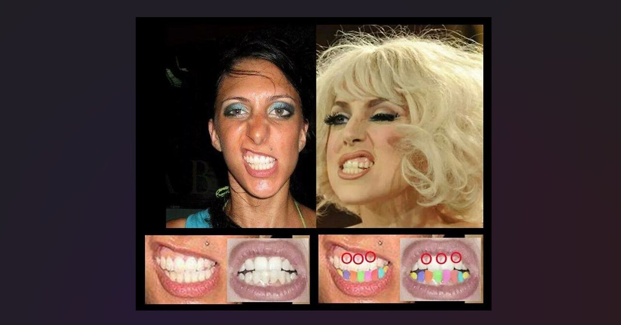 Lady Gaga's Teeth On All Her Characters