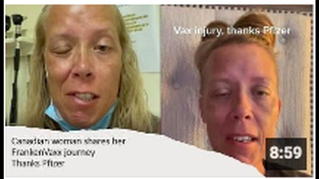 Canadian Woman shares her horrific FrankenVaxx journey (1 year updates)