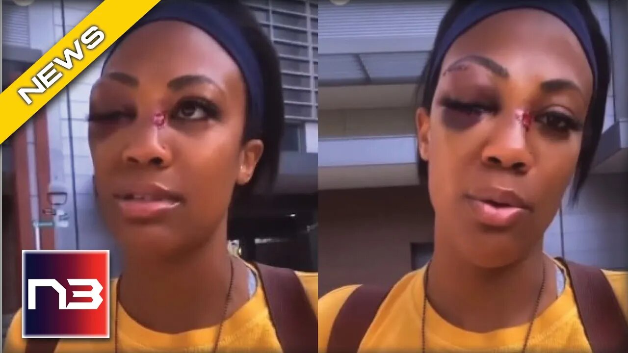 SHOCK VIDEO Shows Olympic Medalist Bashed With Metal Pipe In Face By Homeless In Liberal City