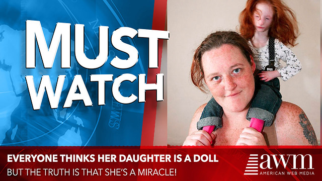 People All Over Think She’s A Doll, But The Truth Mom Reveals Is A Heartbreaking Miracle