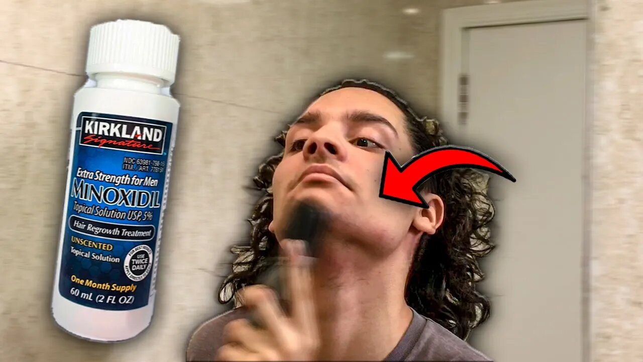 DEIXANDO A BARBA CRESCER COM MINOXIDIL