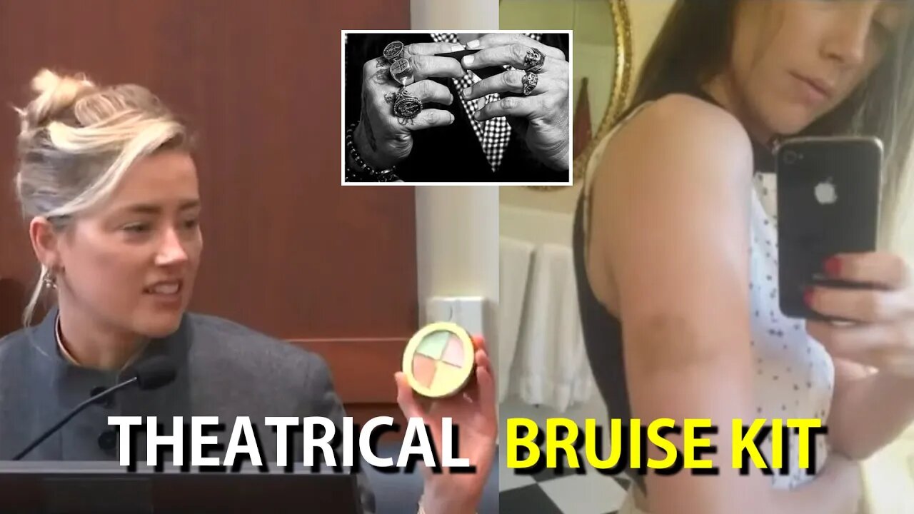 Amber Heard SCREWS UP! More Evidence Shows SHE FAKED BRUISES On Face