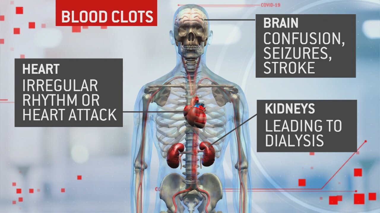 Make It Hard To Talk? Die From Covid Blood Clot Shots