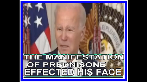 THE MANIFESTATION OF PREDNIZONE EFFECTED HIS FACE