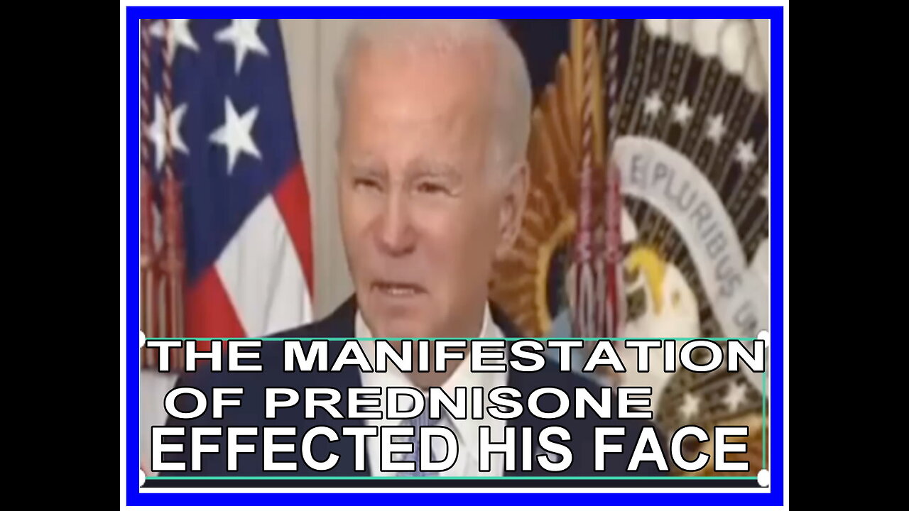 THE MANIFESTATION OF PREDNIZONE EFFECTED HIS FACE