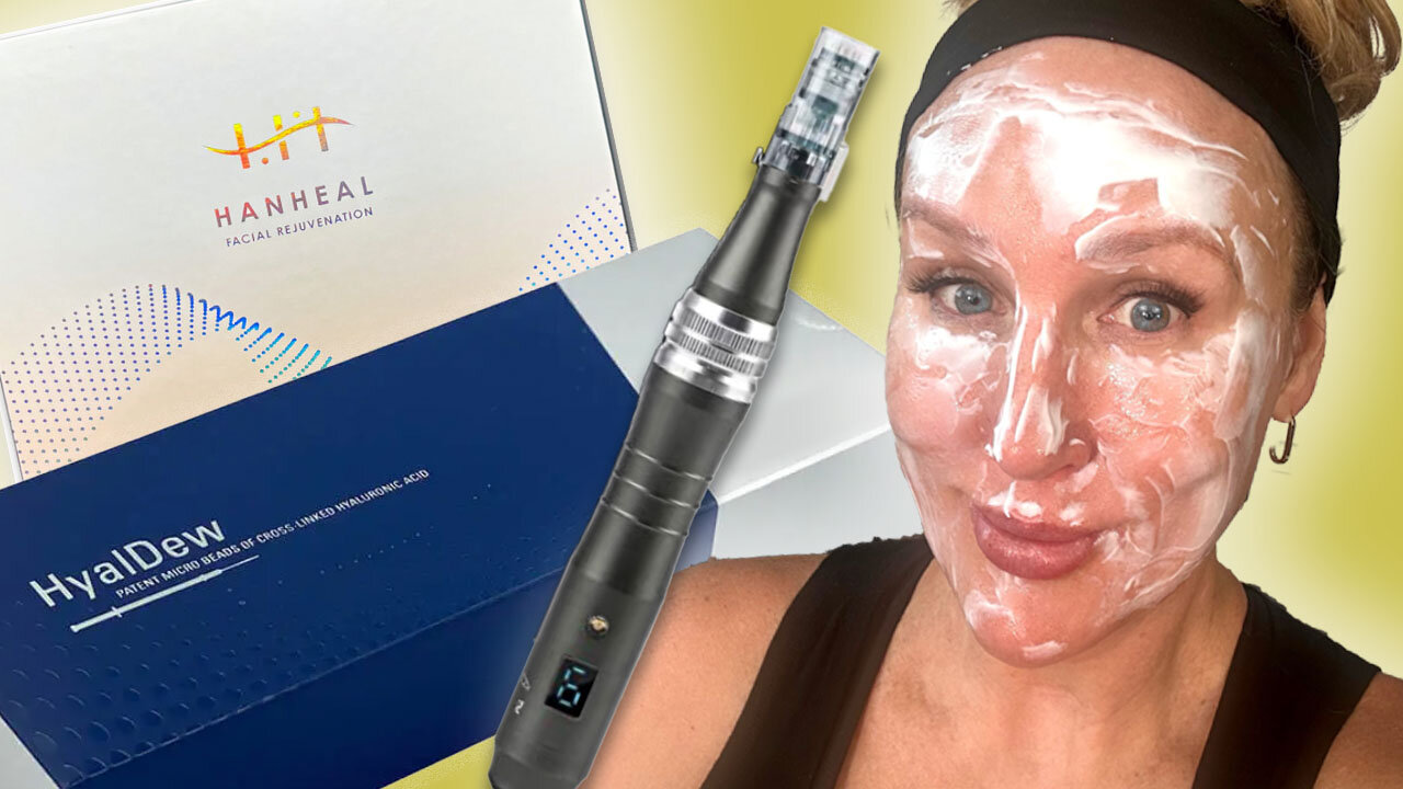 Microneedling Dermaheal Exosomes & HyalDew Shine