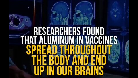Aluminium adjuvants in vaccines: Highly neurotoxic, bio-accumulate, cause auto-immune disease