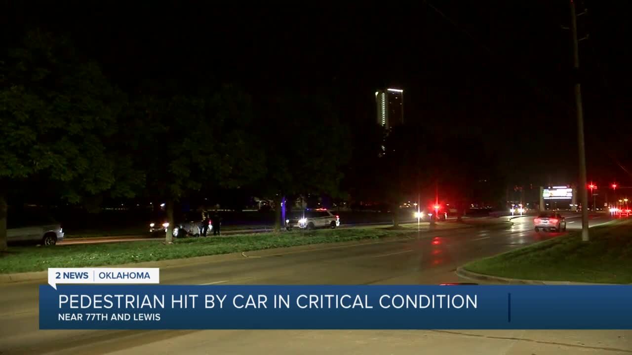 Man hit by car in critical condition