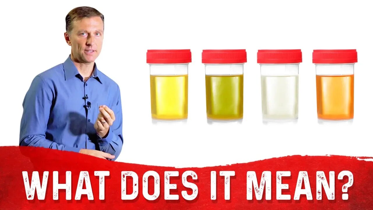 What Does The Color Of Urine Tell You About Your Body? – Dr.Berg