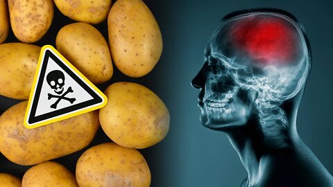 These Foods Bring Your Brain Down Without You Knowing