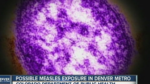 Possible measles exposure in Denver/Boulder area