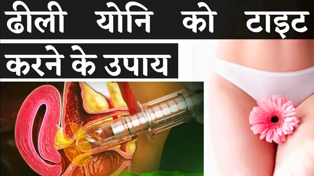 #video योनि को टाइट कैसे करें - Yoni ko Tight kaise kare #sexual treatment