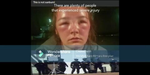 AUSTRALIAN POLICE LITERALLY COOKING PEACEFUL FREEDOM PROTESTERS.