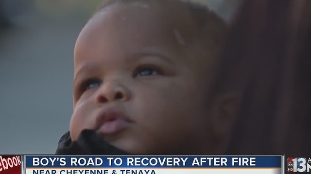 Operation FireHEAT brings gifts to baby burned in fire