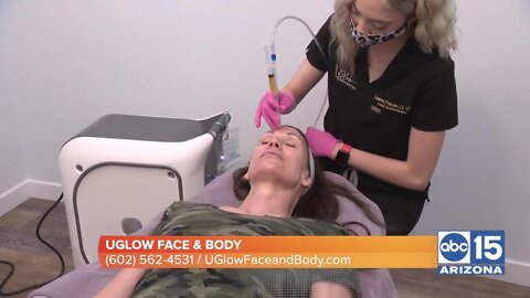 Get your glow on with Morpheus8 available at UGlow Face & Body