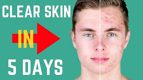 how to get glass skin as a man