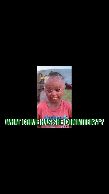 Scarred for Life (Physically & Psychologically)