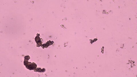 GRAPHENE OXIDE and components belonging to NANO TECHNOLOGY | NEWS-19