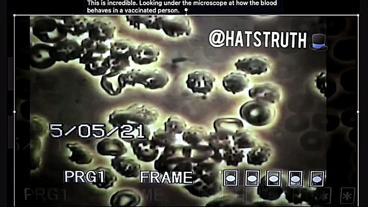 All We Know - Vaccination Truth