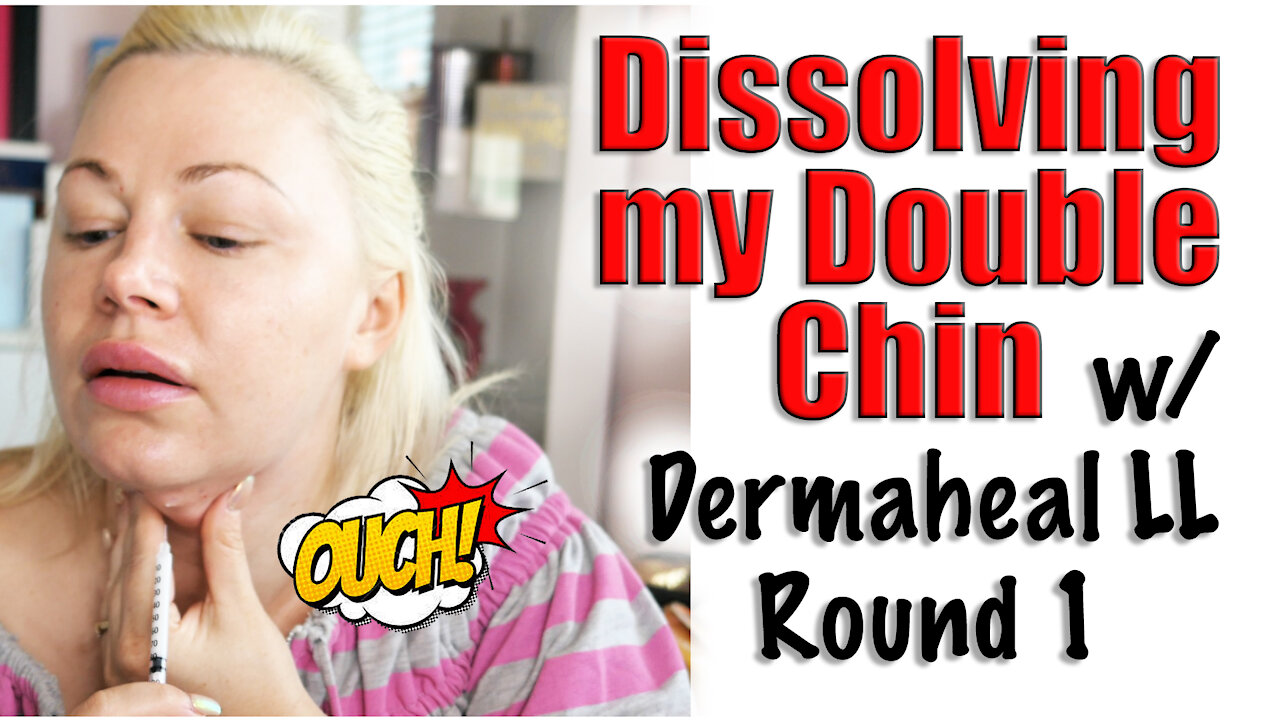 Dissolving My Double Chin with Dermaheal LL | Code Jessica10 saves you $$$