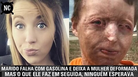 Marido falha com gasolina e deixa a mulher deformada. Mas o que ele faz em seguida, ninguém esperava