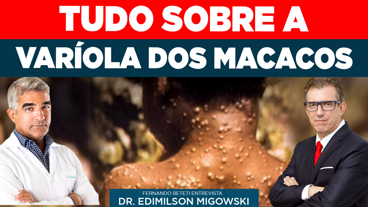 TUDO SOBRE A VARÍOLA DOS MACACOS | DR. EDIMILSON MIGOWSKI - FERNANDO BETETI